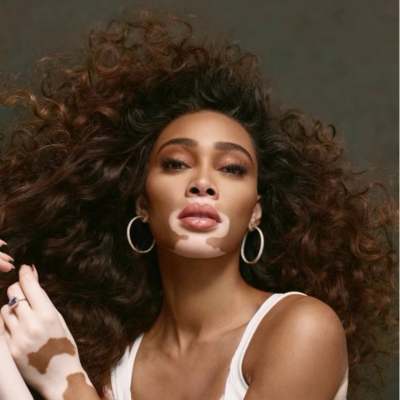 Winnie Harlow